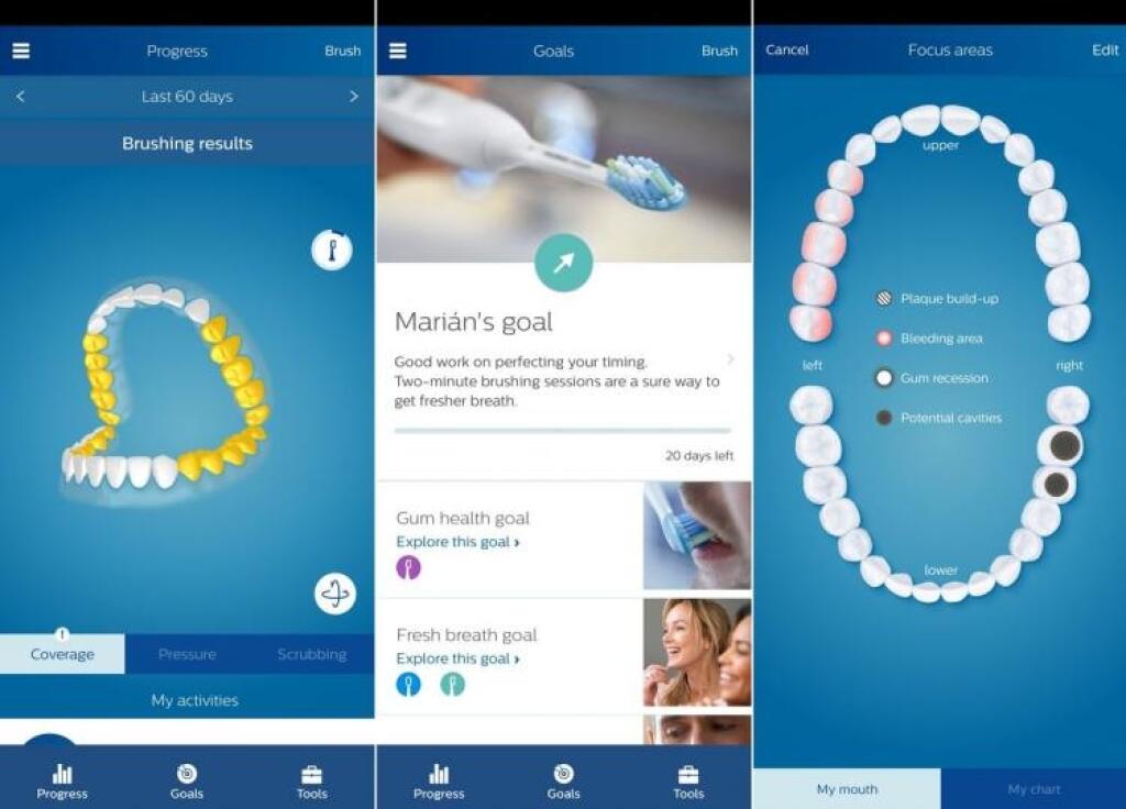 Sonicare DiamondClean Smart: Ako si čistiť zuby s mobilom