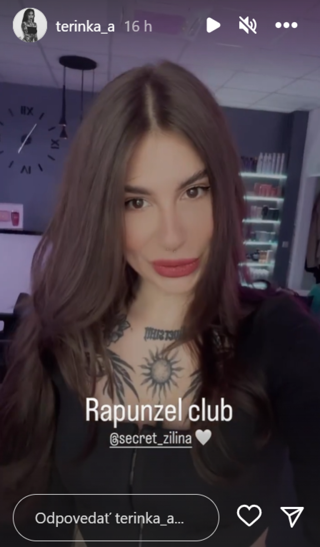 Foto Tereza Z Ruže Po šou Sa Nechala Vylepšiť Aj Ona Botox A