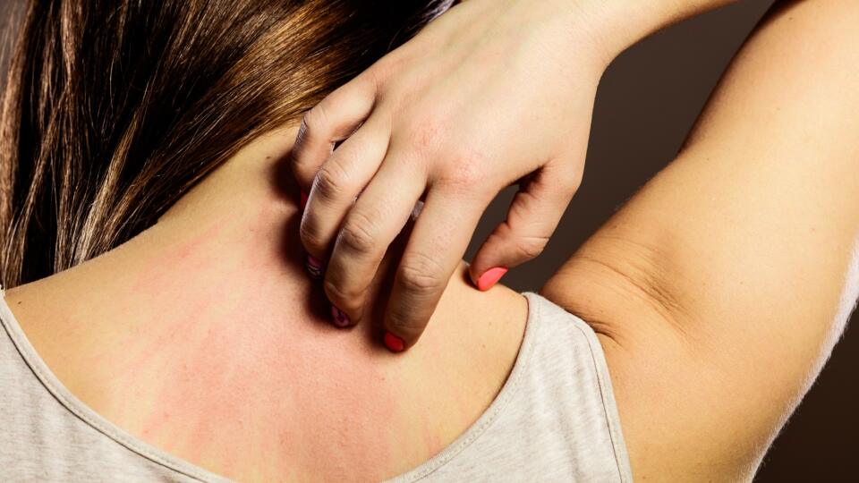 Woman scratching her back closeup