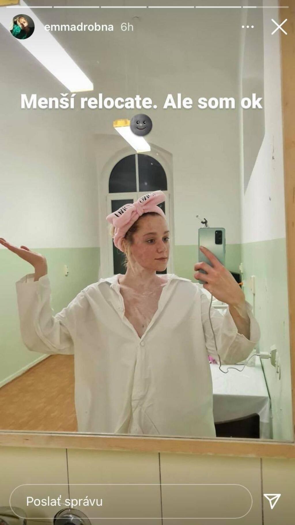 Emmu Drobnú postihla silná reakcia na tvári.