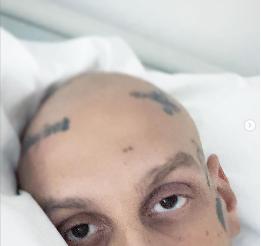 Separ sa liečil 3 mesiace na onkologické ochorenie.