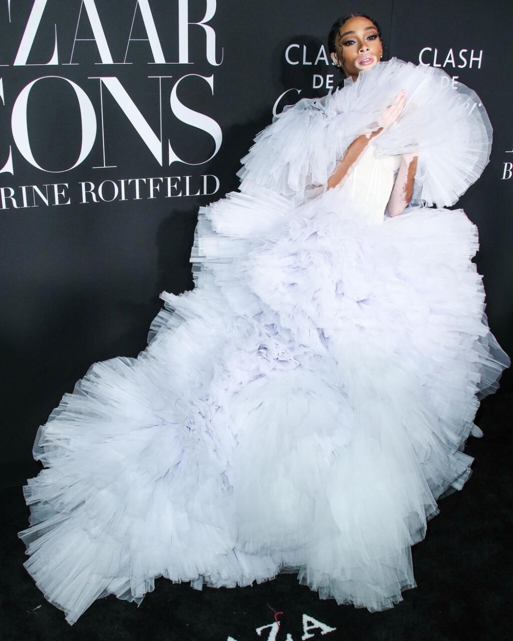 Modelka Winnie Harlow.