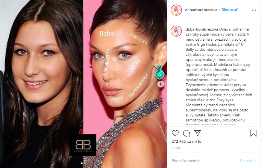 Modelka Bella Hadid (23)