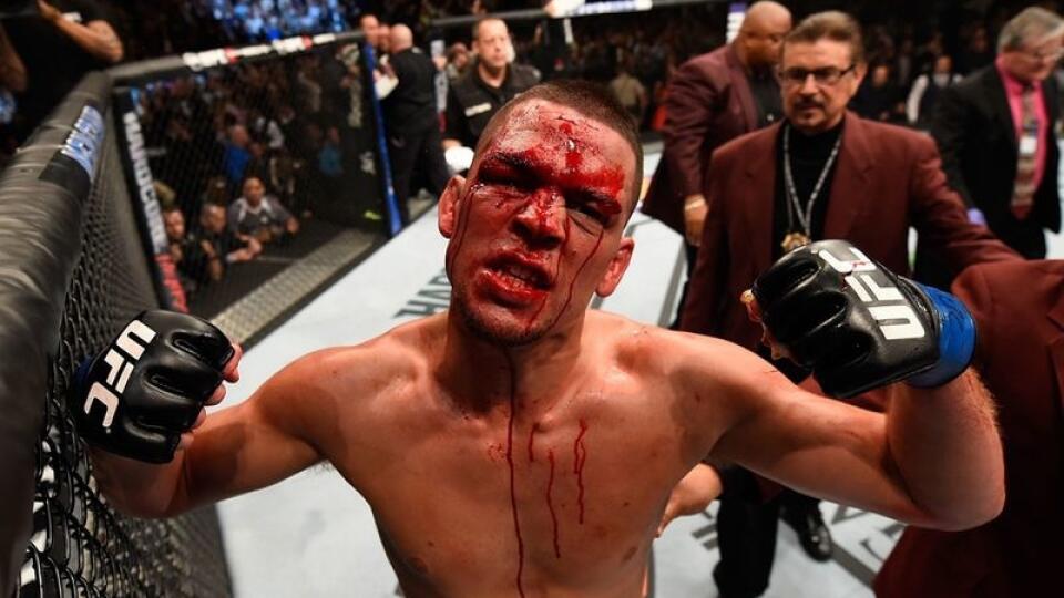 Nate Diaz.