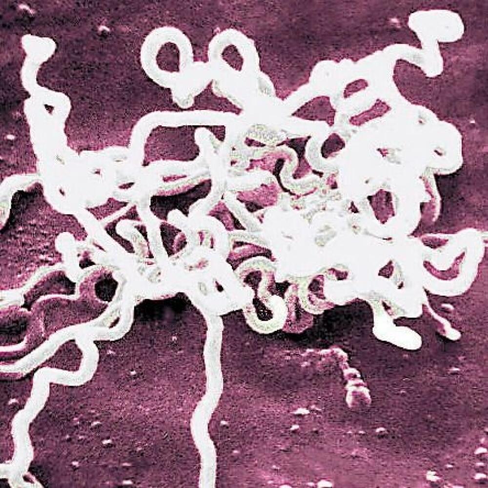 Syfilis