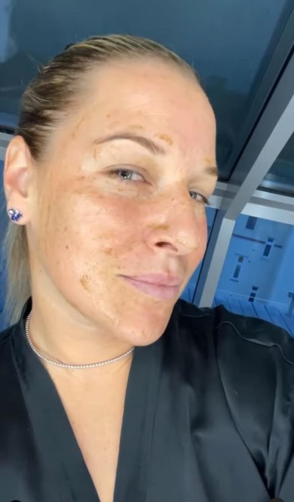 Dominika Cibulková natočila krátke video, ako si dáva do poriadku svoju pleť.