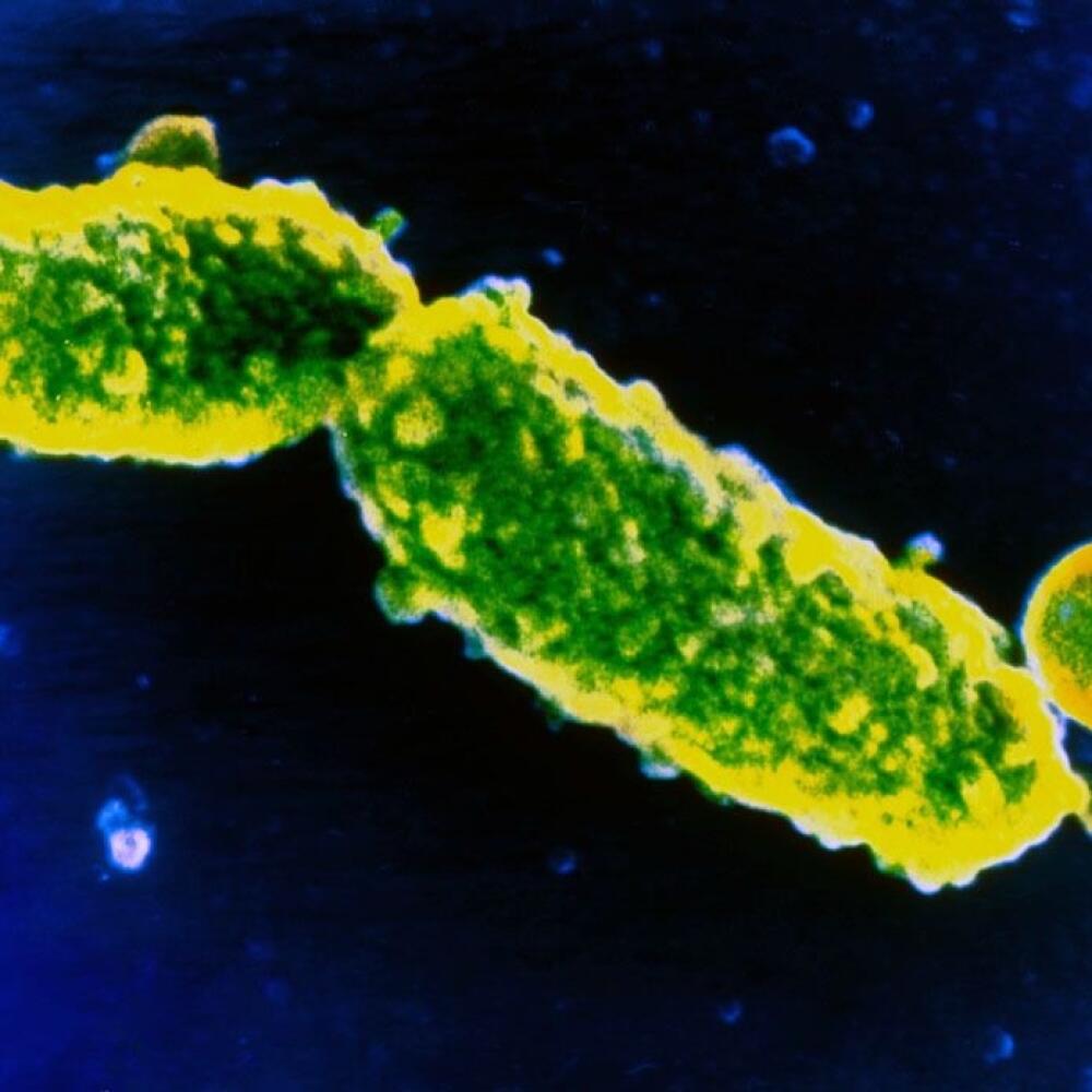 Baktéria Bordetella pertussis, ktorá chorobu spôsobuje.