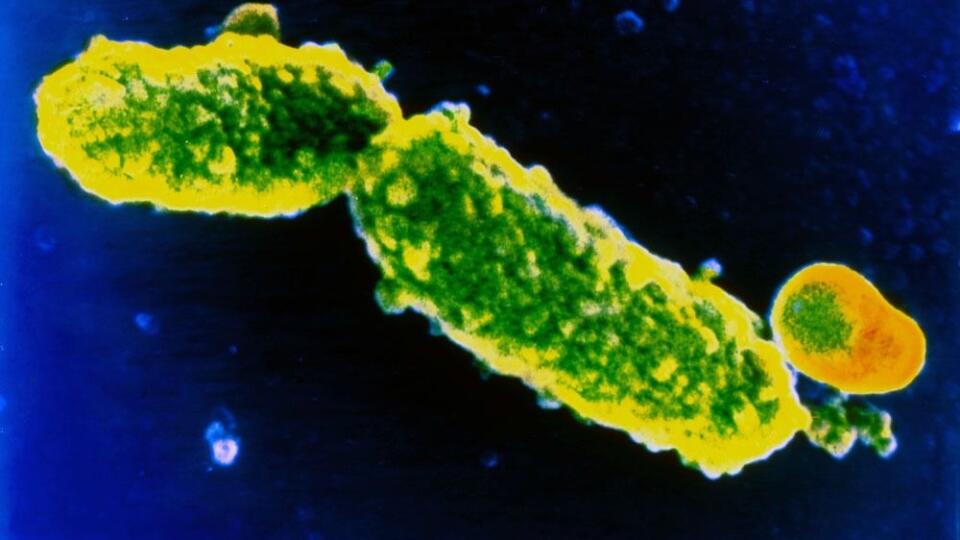 Baktéria Bordetella pertussis, ktorá chorobu spôsobuje.