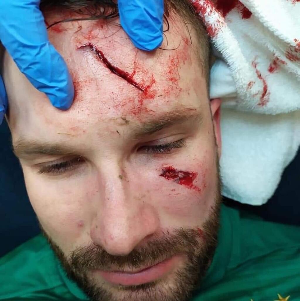 Takto vypadala tvár brankára Slavie bezprostredne po šialenom zákroku.