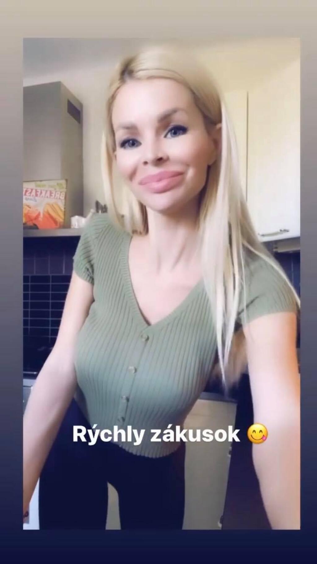 Prirodeznosť Silvii Kucherenko dlho nevydržala. Opäť má akési väčšie pery.
