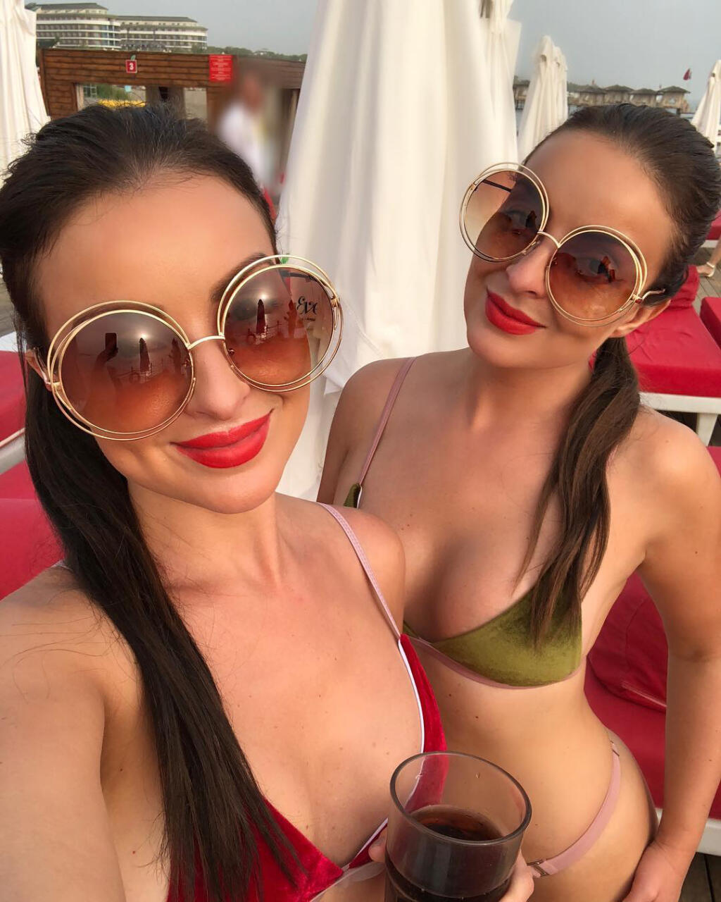 Dvojičky a speváčky Daniela a Veronika dávnejšie podstúpili úpravu poprsia.