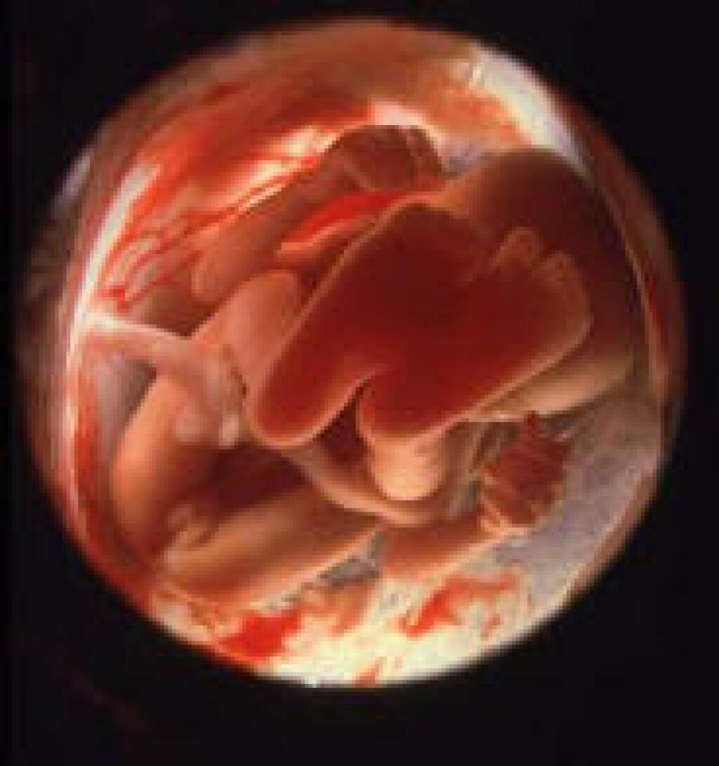 20 недель половина. Зародыш ребенка в 20 недель беременности. Плод ребенка в 20 недель беременности. Плод на 20 неделе беременности. Эмбрион на 20 неделе беременности фото.