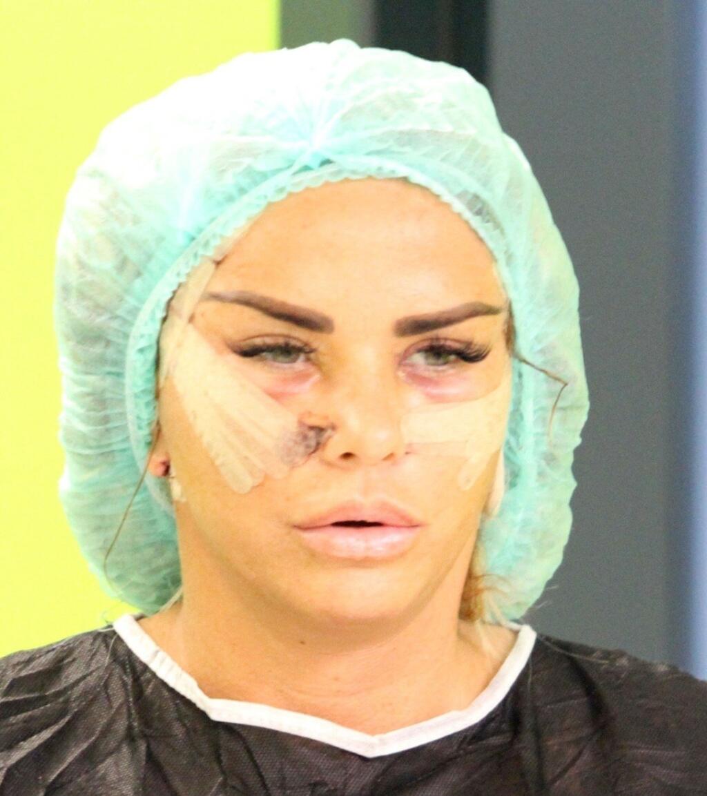 Anglická sexbomba má za sebou množstvo plastických operácií, pri ktorých si nechala upraviť snáď všetky časti tela. Zábery