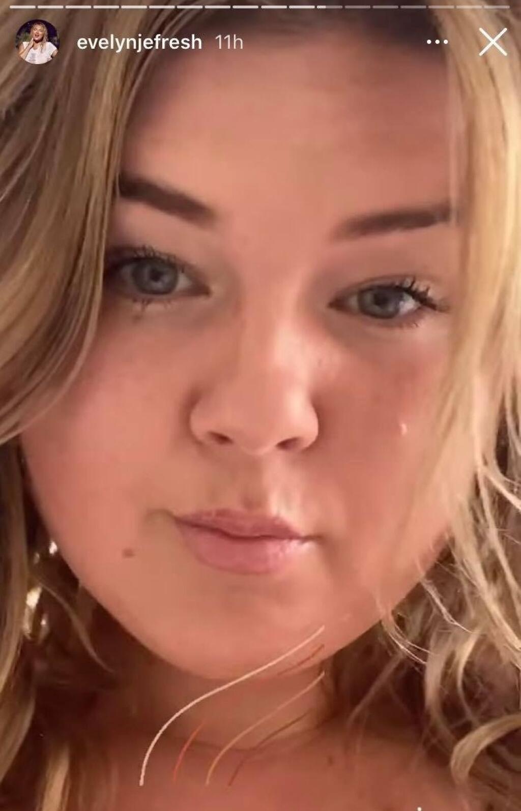 Apríl 2021: Evelyn zmenila farbu vlasov a mierne si dala upraviť pery.