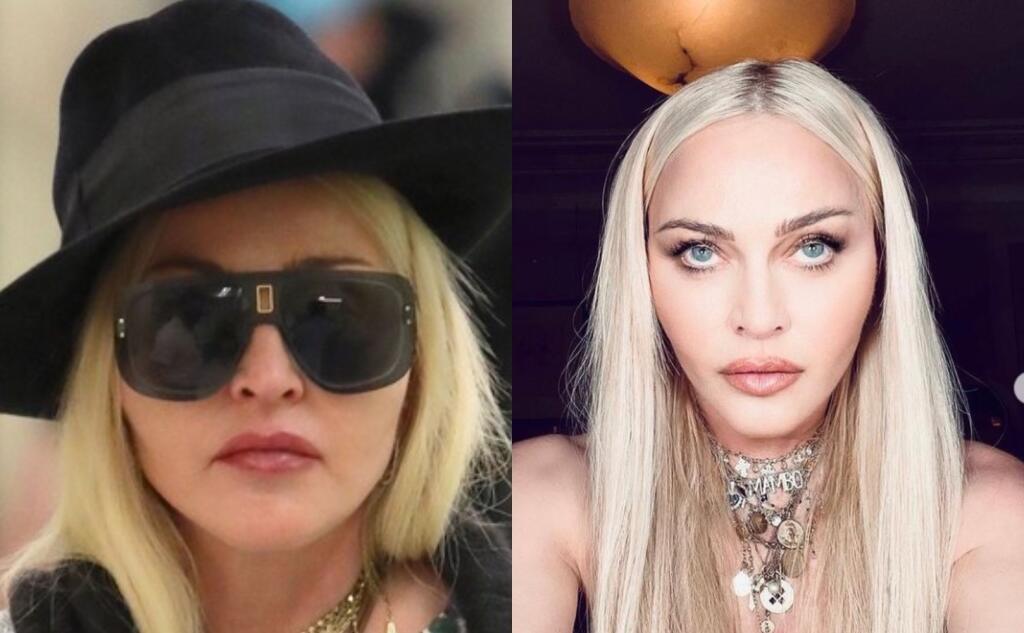 Madonna.
