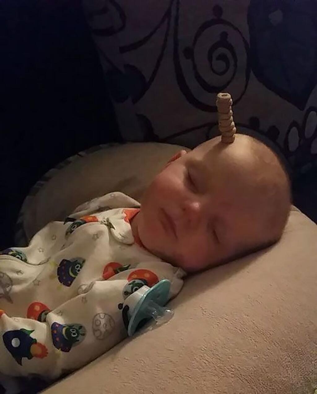 Ребенок родился без головы