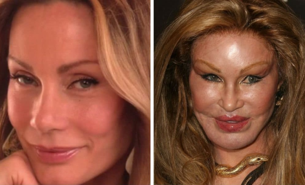 Jocelyn Wildenstein