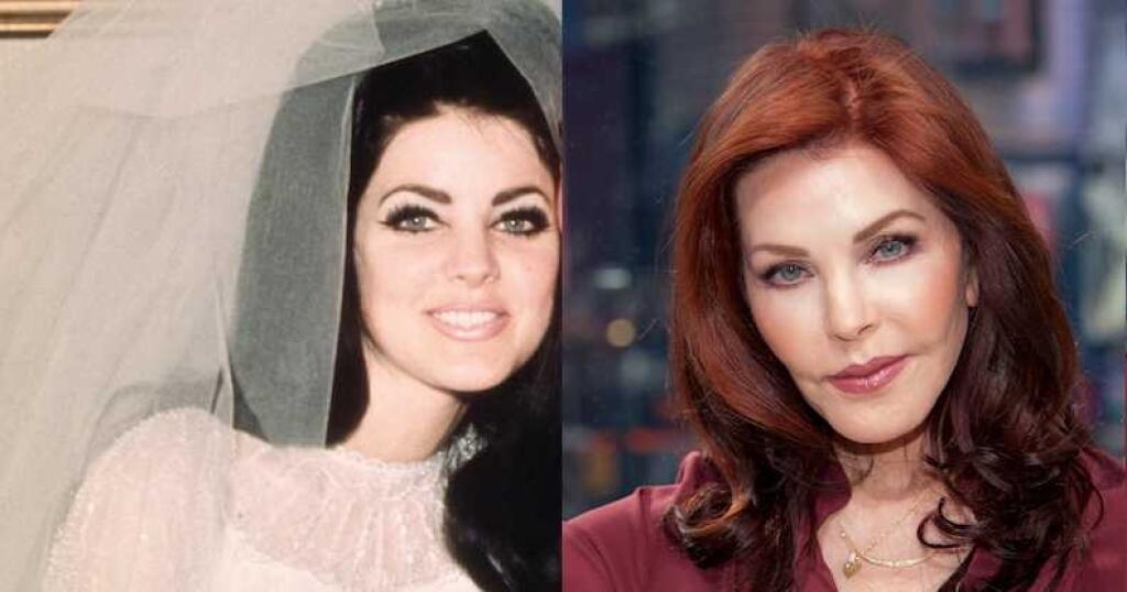 Priscilla Presley pred a po plastikách