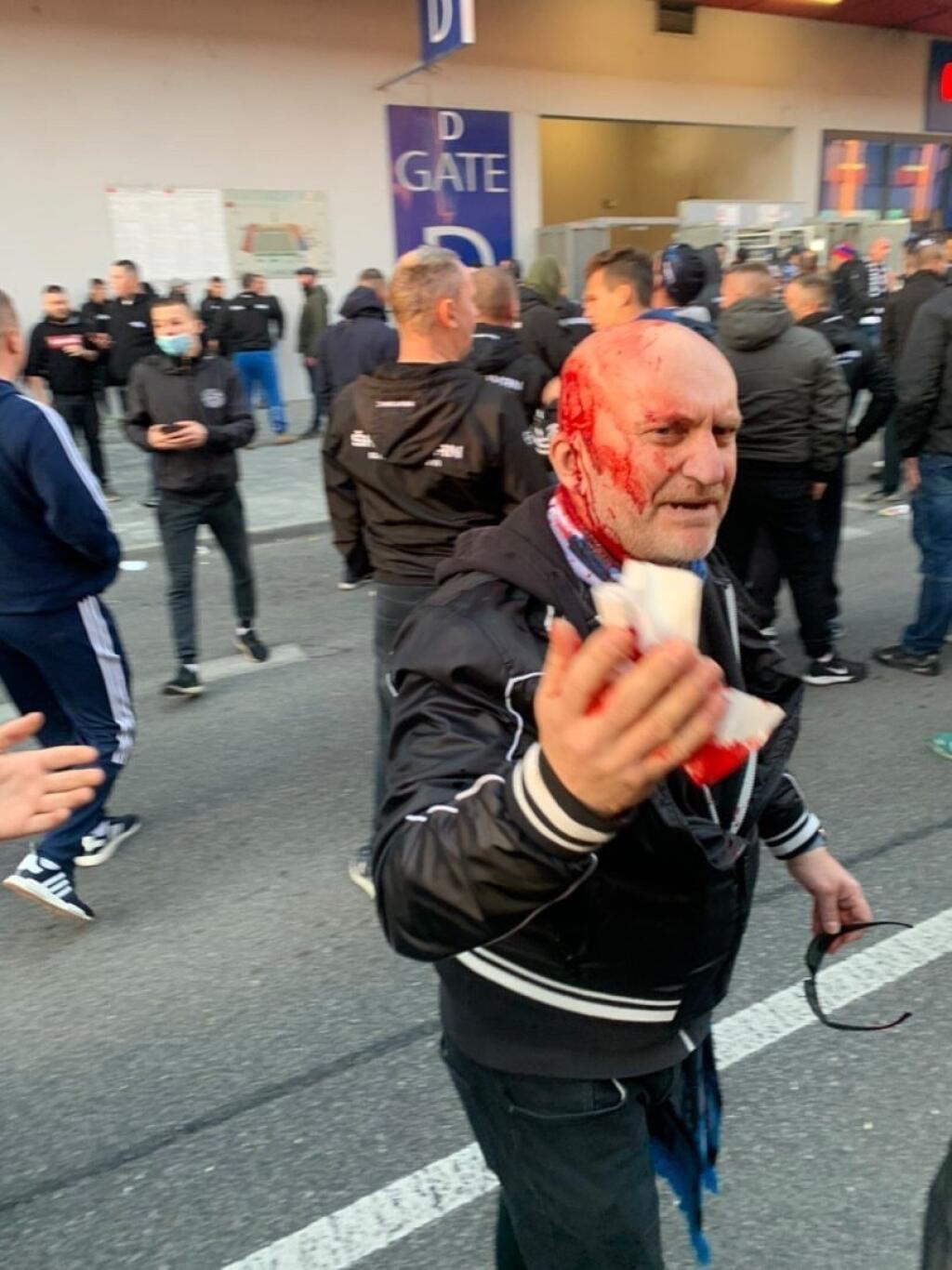 Mnohí z fanúšikov skončili s rozbitými hlavami a tržnými ranami.