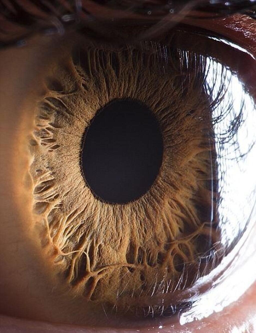 File:The human eye.JPG - Wikimedia Commons