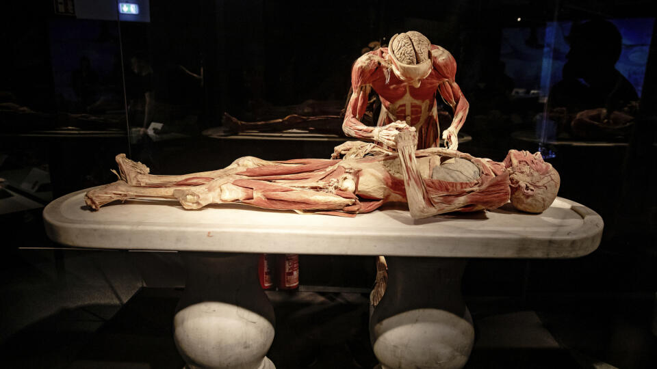 Za kontroverznú označili výstavu mŕtvych tiel  Body Worlds viacerí odborníci a mimovládne organizácie. Problém s ňou majú aj hygienici.