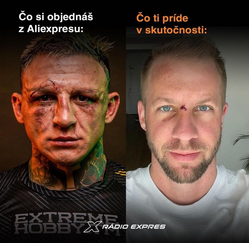 Matúš Krnčok si zranil nos.