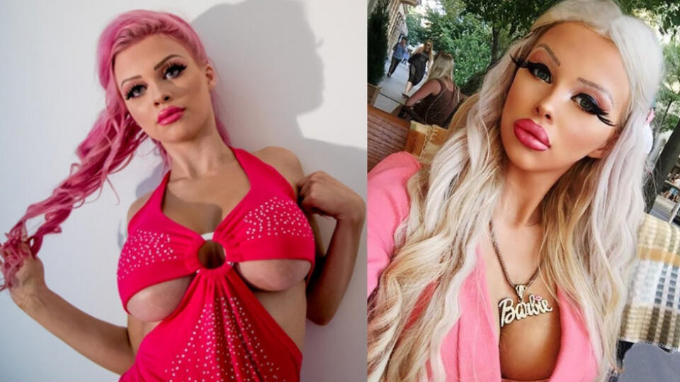 Česká Barbie: Má pred sebou ešte mnoho plastík.