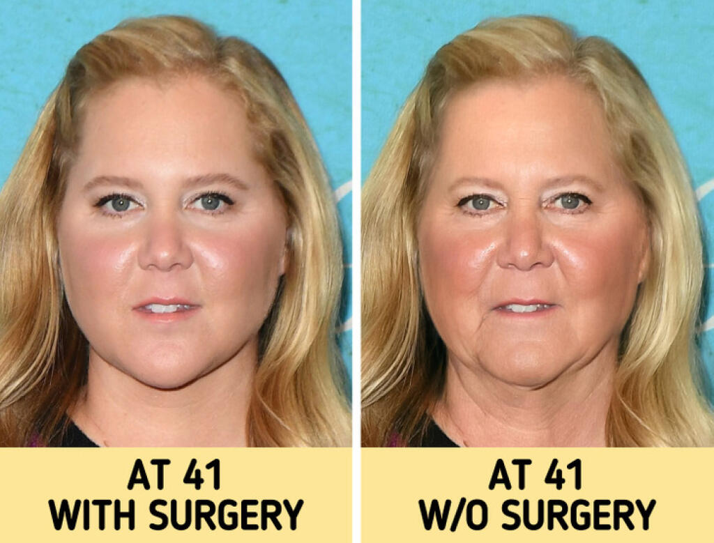 Amy Schumer