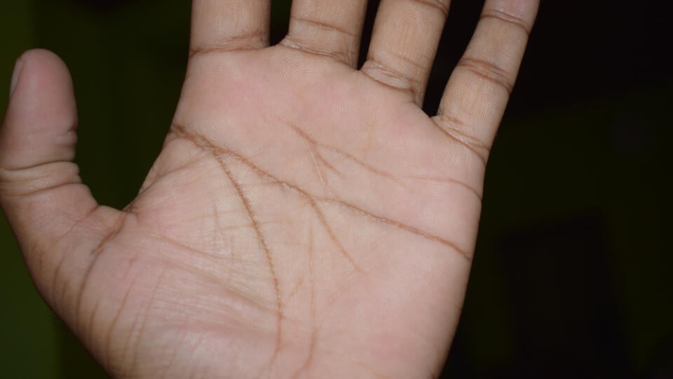 Closeup,View,Of,Young,Human,Hand,(simianline,,Simian,Line,On