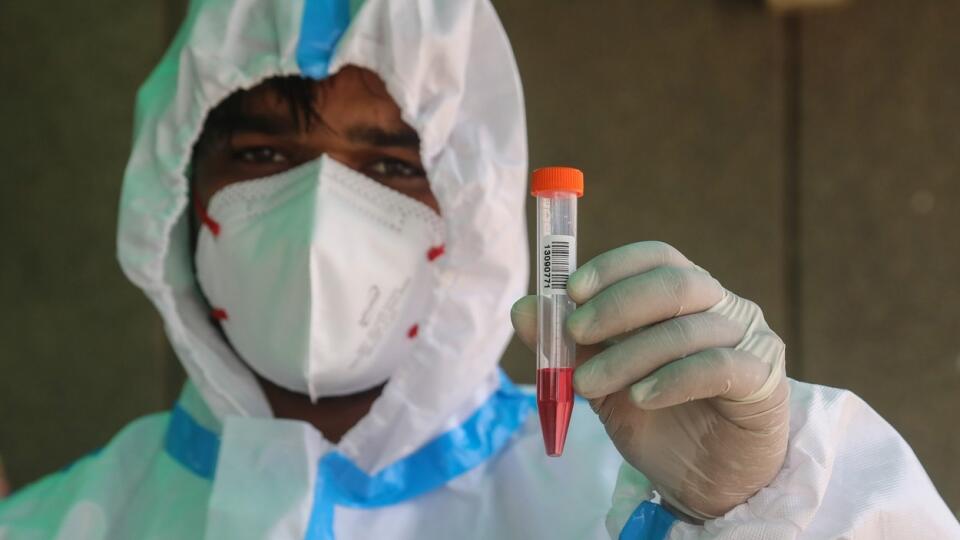 Najnovší rýchly nárast infekcií spôsobil, že India zaznamenala celkovo 13,5 milióna infikovaných, čo je viac než 13,48 milióna v Brazílii.