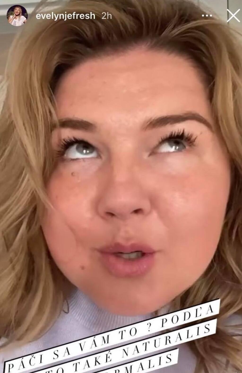Apríl 2021: Evelyn zmenila farbu vlasov a mierne si dala upraviť pery.