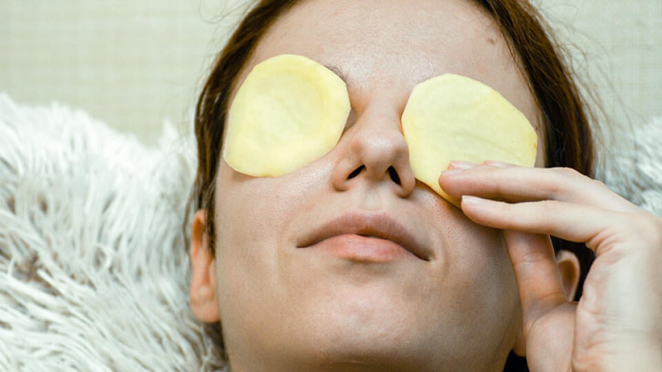 Self,Portrait:,Redhead,Model,Using,Potato,Slices,To,Relieve,The