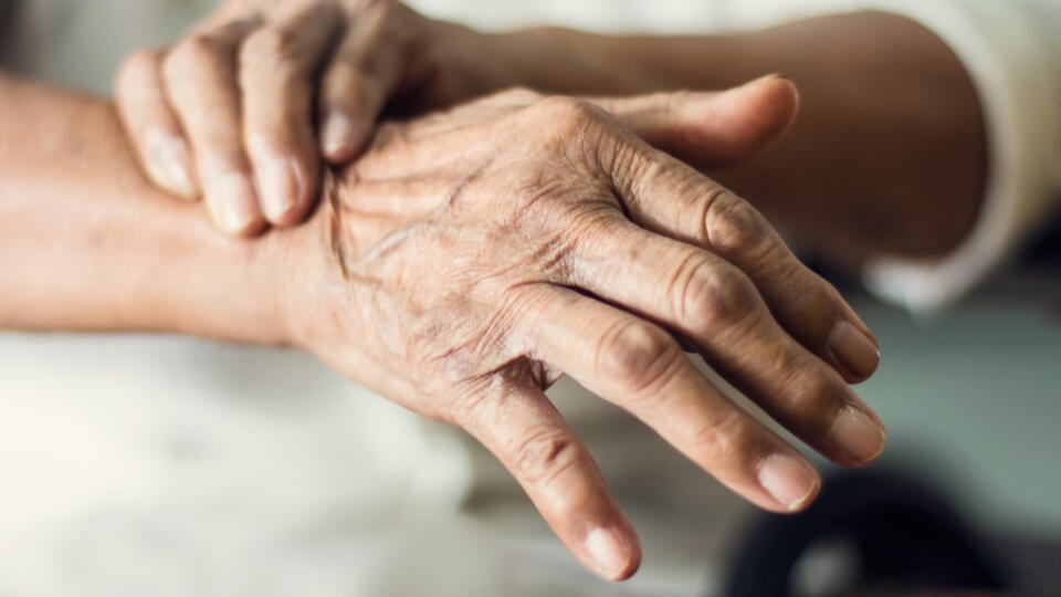 Close,Up,Hands,Of,Senior,Elderly,Woman,Patient,Suffering,From