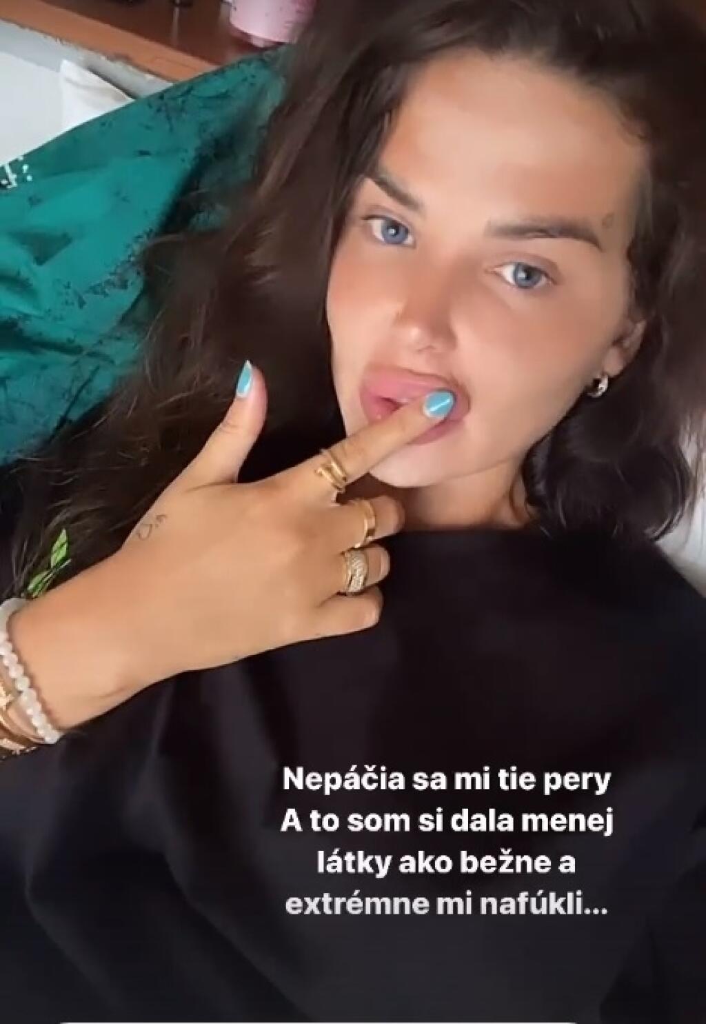 Zuzana sa sťažuje na jej veľké pery.