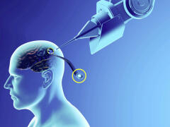 Prvý človek s čipom v mozgu: Vráti nám toto zariadenie schopnosť pohybovať sa a komunikovať?