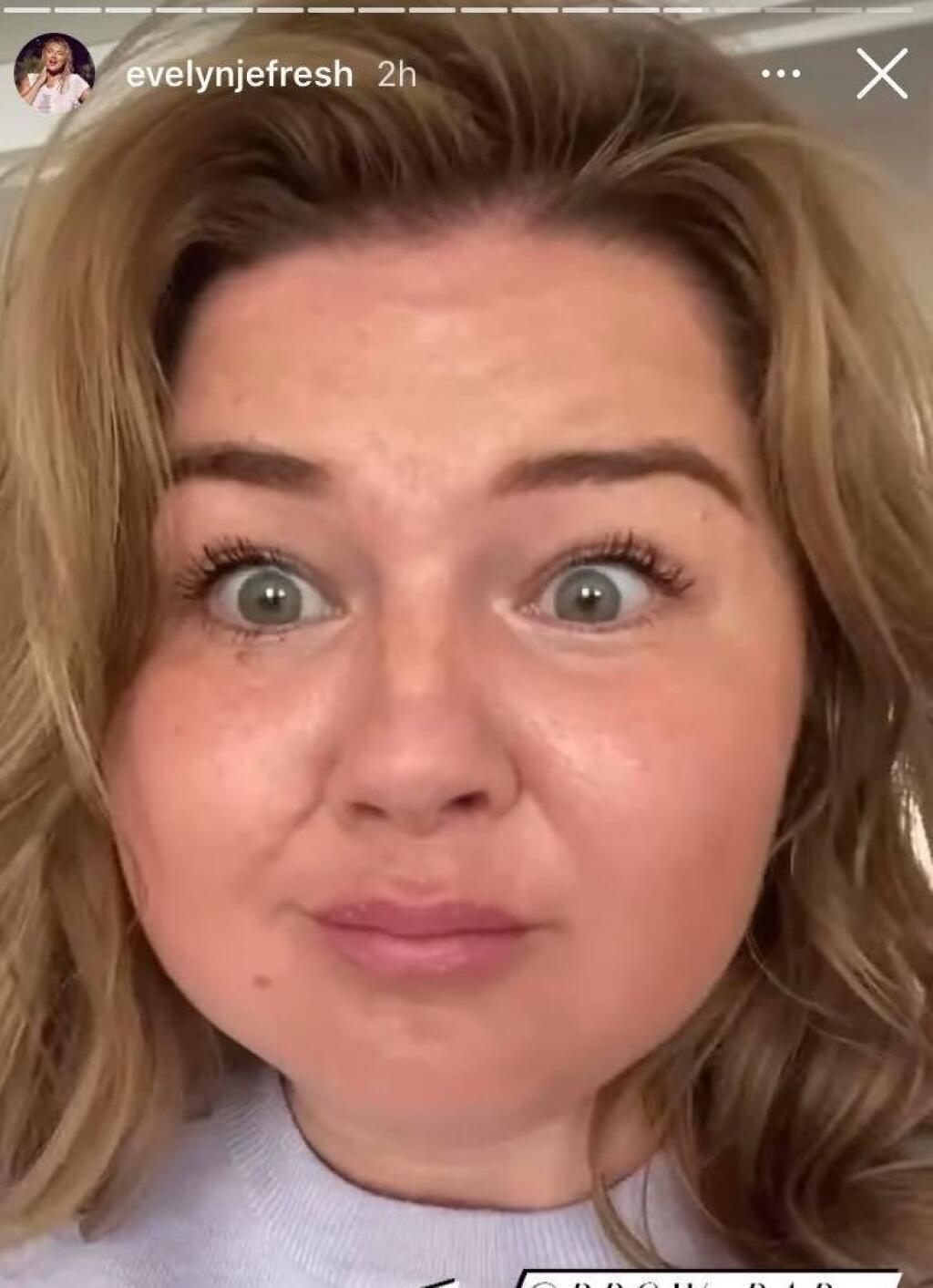 Apríl 2021: Evelyn zmenila farbu vlasov a mierne si dala upraviť pery.