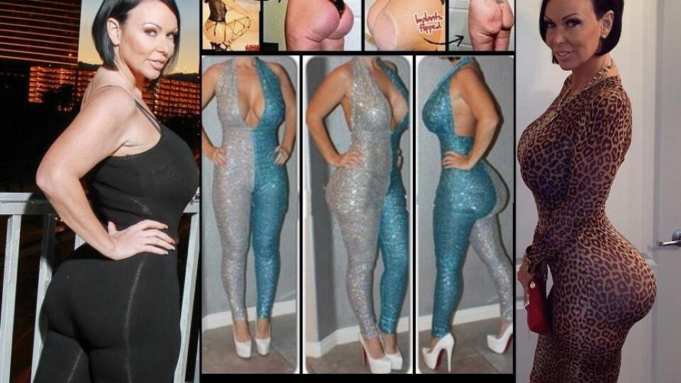 Striptérka Renee Talley za nevydarenú plastiku