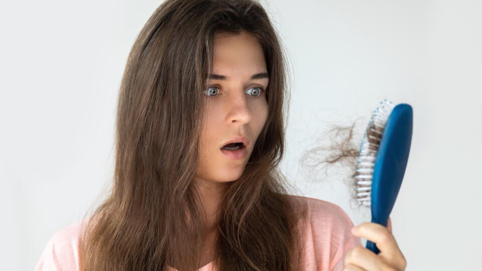 Young,Woman,Is,Very,Upset,Because,Of,Hair,Loss