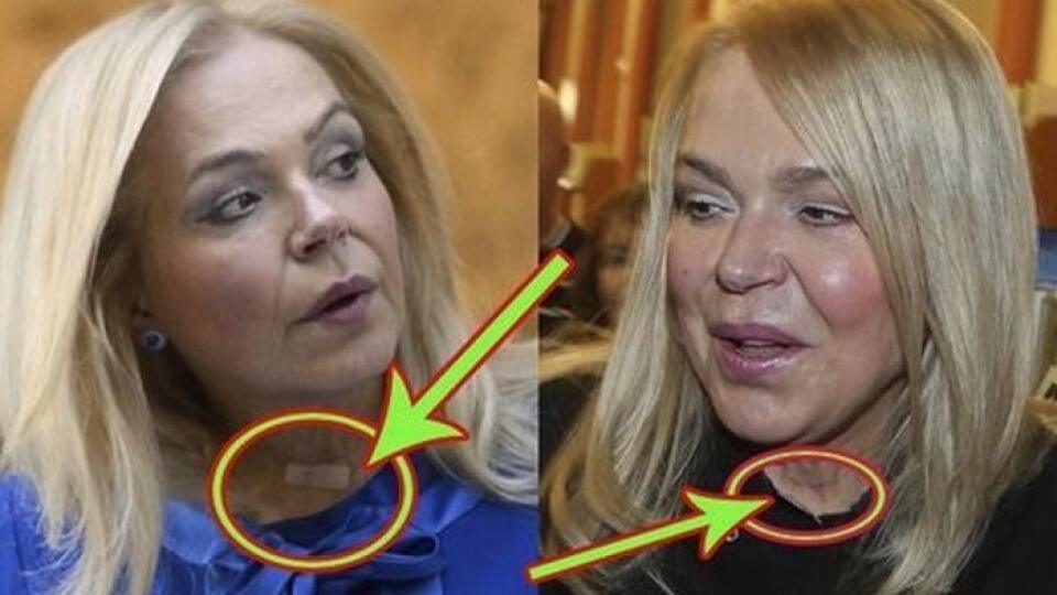 Dagmar Havlová sa pravdepodobne musela podrobiť