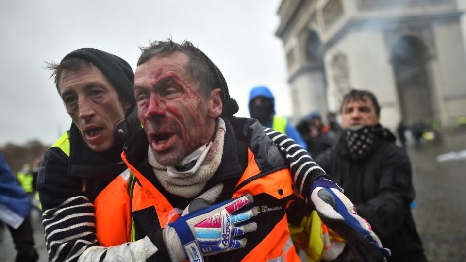  V celej krajine sa sobotňajších protestov zúčastnilo 36.000 ľudí, pričom toto číslo zahŕňa aj 5500 demonštrantov v Paríži. Ľahké zranenia utrpelo aj desať policajtov.