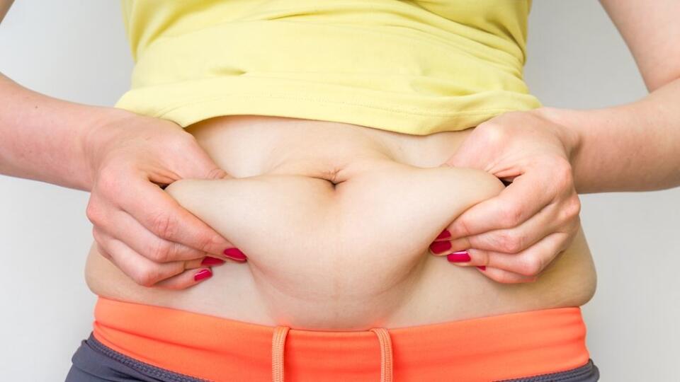 abdominoplastika