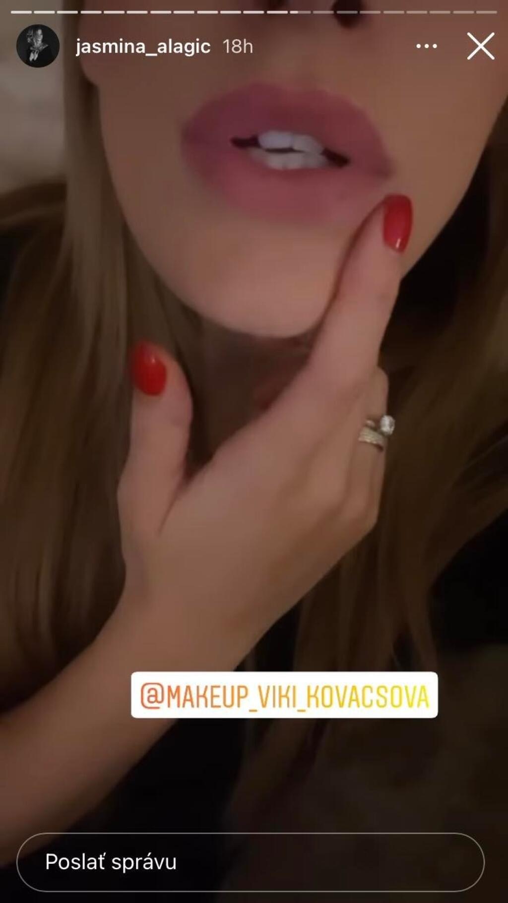 Jasmina Alagič Vrbovská ukázala nové pery.