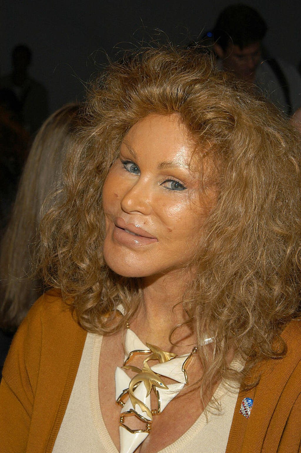 Smutné FOTO Kedysi Krásnej Jocelyn Wildenstein: V Mladosti Bola Krásna ...