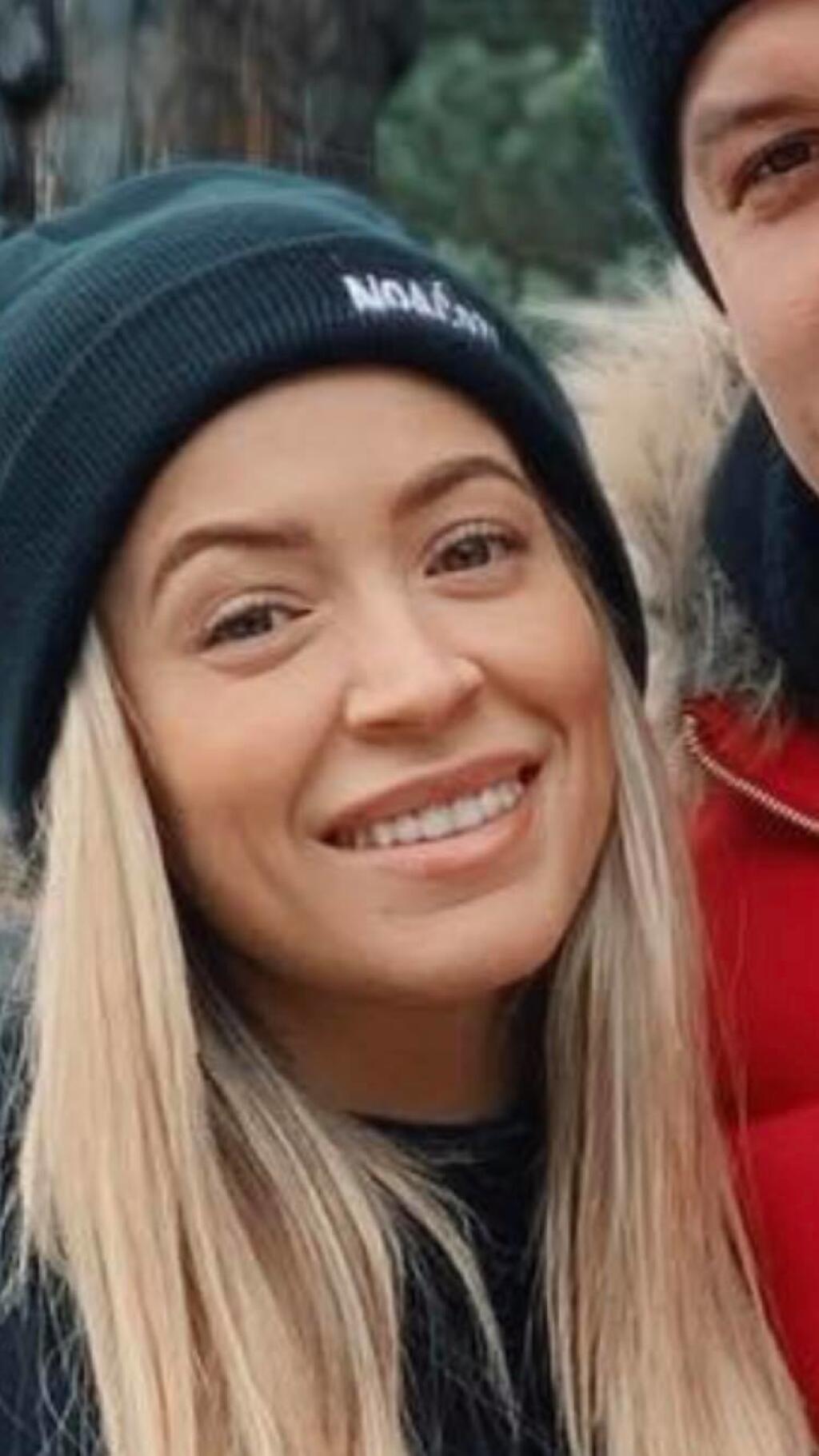 Dominika Mirgová síce zatiaľ priznala iba silikóny, no v tvári sa v poslednej dobe úplne zmenila.