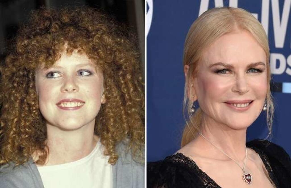 Nicole Kidman