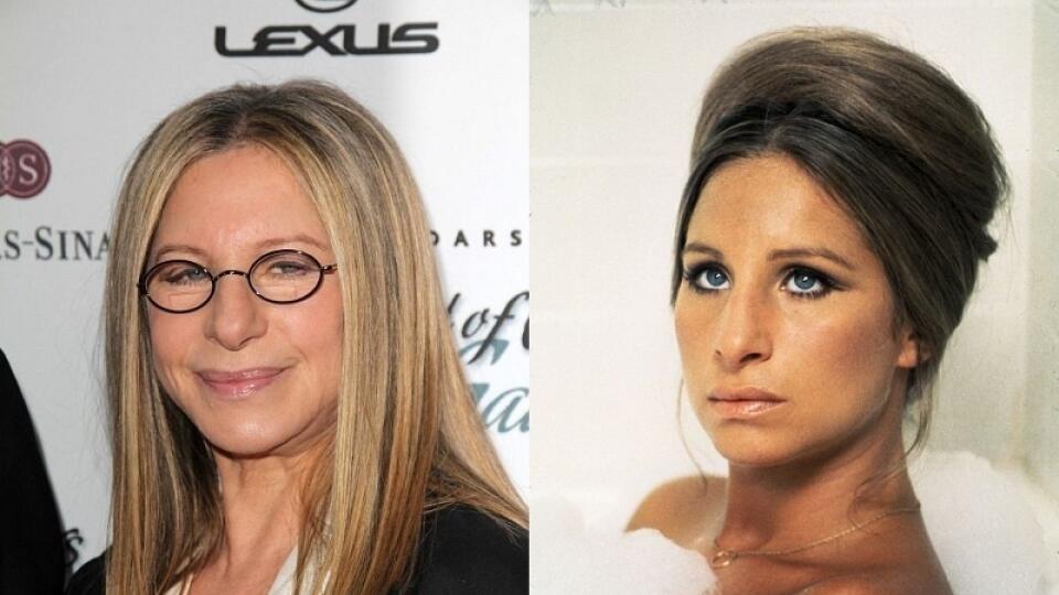 Tvár Barbry Streisand pôsobí veľmi neprirodzene.