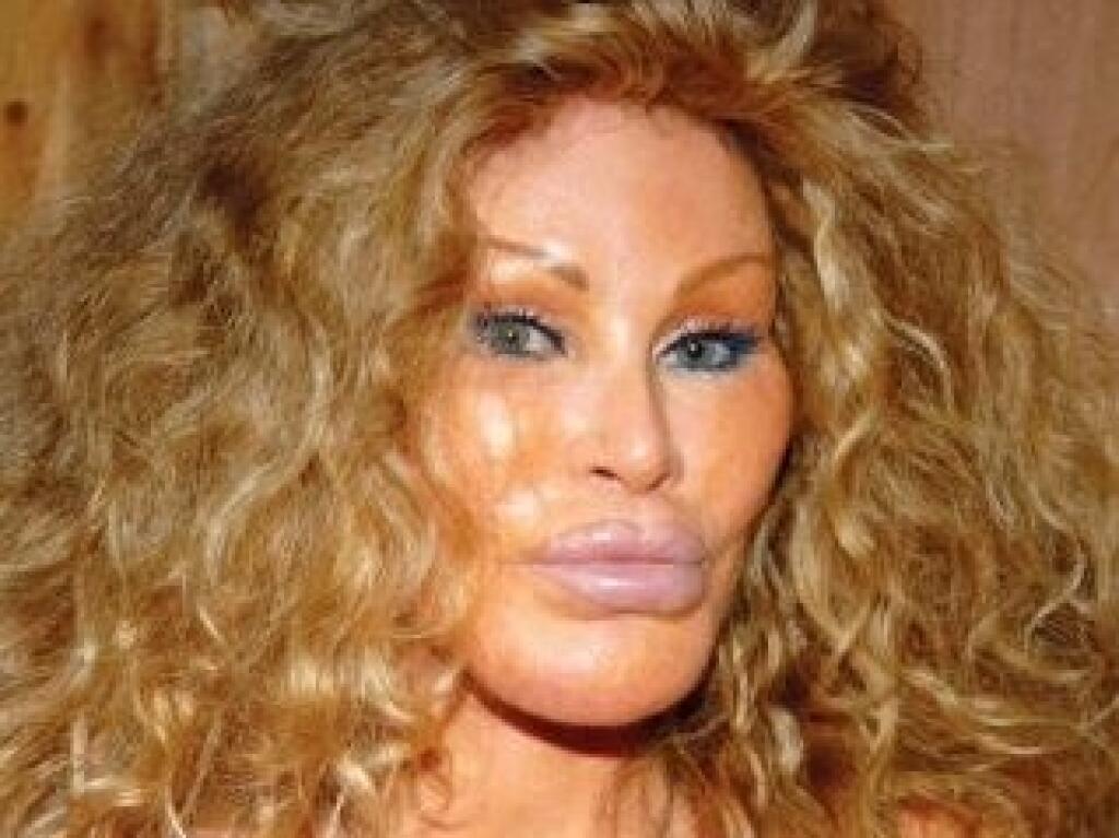 Smutné Foto Kedysi Krásnej Jocelyn Wildenstein V Mladosti Bola Krásna Ako Obrázok Zničila Sa 