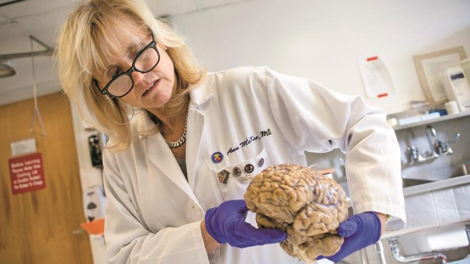 Ann McKeeová: „Vo výskume poškodení mozgu hokejistov sme zďaleka nepokročili tak ako pri hráčoch amerického futbalu. Nemáme totiž dosť materiálu,“ ťažká si neuropatologička.