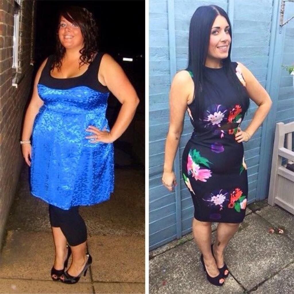 Отзывы реально похудевших людей. Похудение до и после. До и после похудения девушки. Похудела до и после. Женщина похудела до и после.