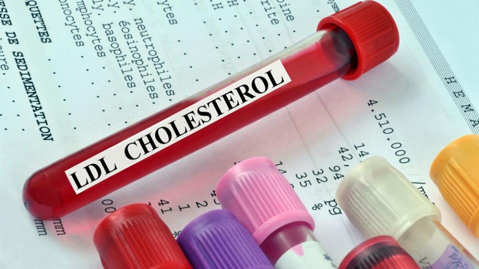 Nulový cholesterol by mal byť práve "zlý" LDL cholesterol, nie "dobrý" HDL cholesterol.